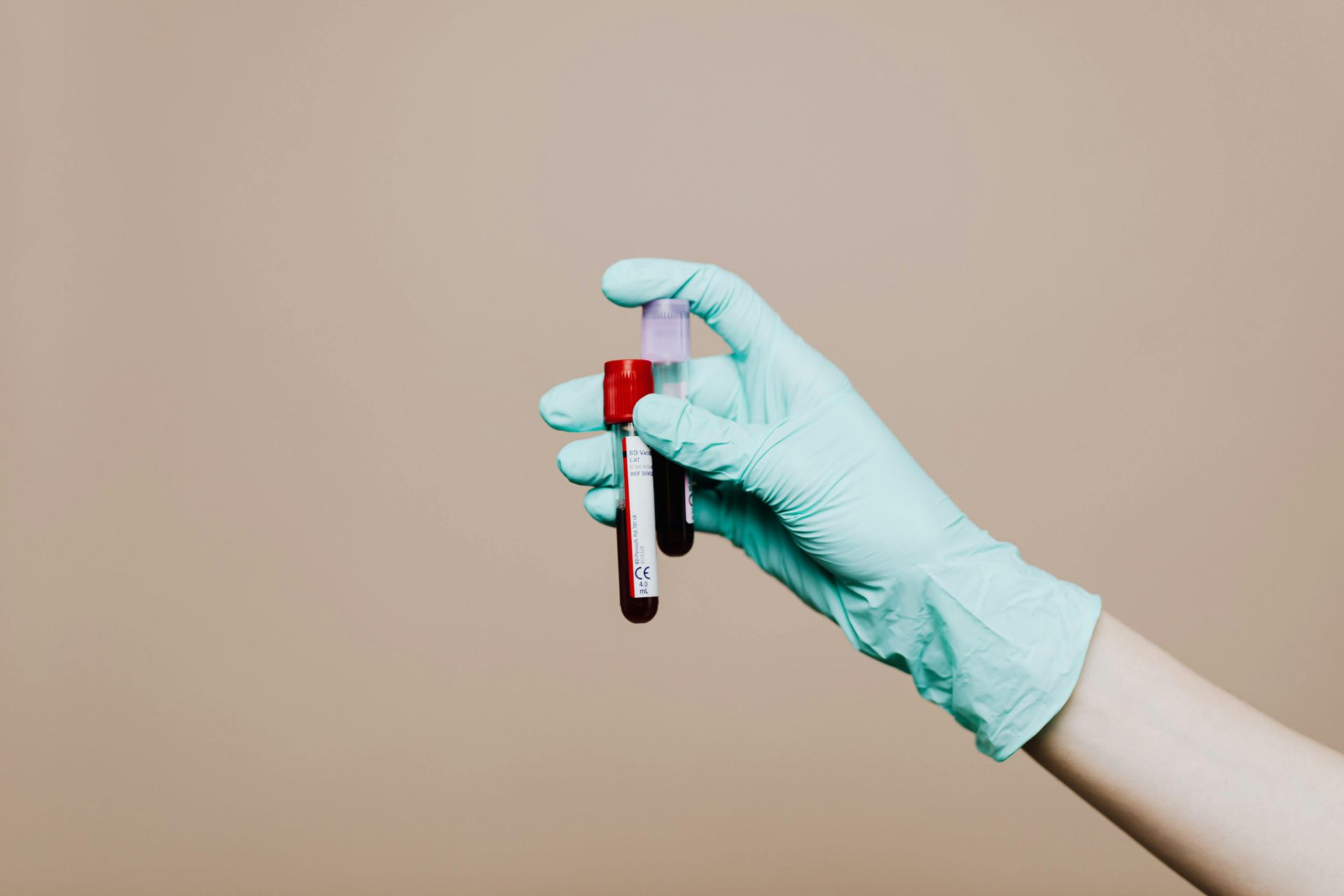 You are currently viewing Blood Urea Nitrogen Test: Everything You Need to Know