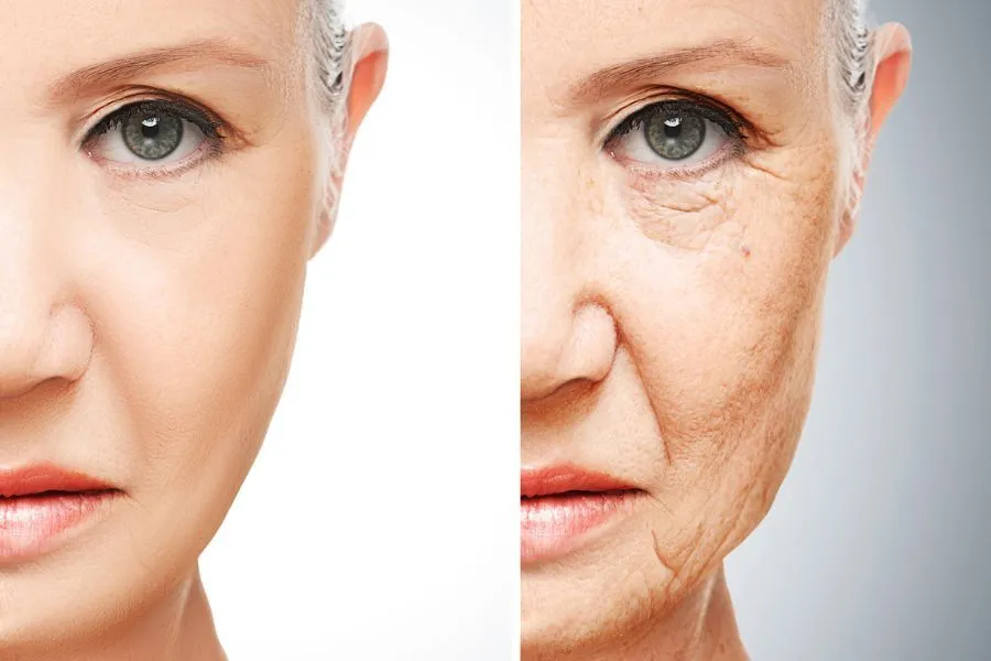 You are currently viewing The Truth About Ozempic Face: What You Need to Know