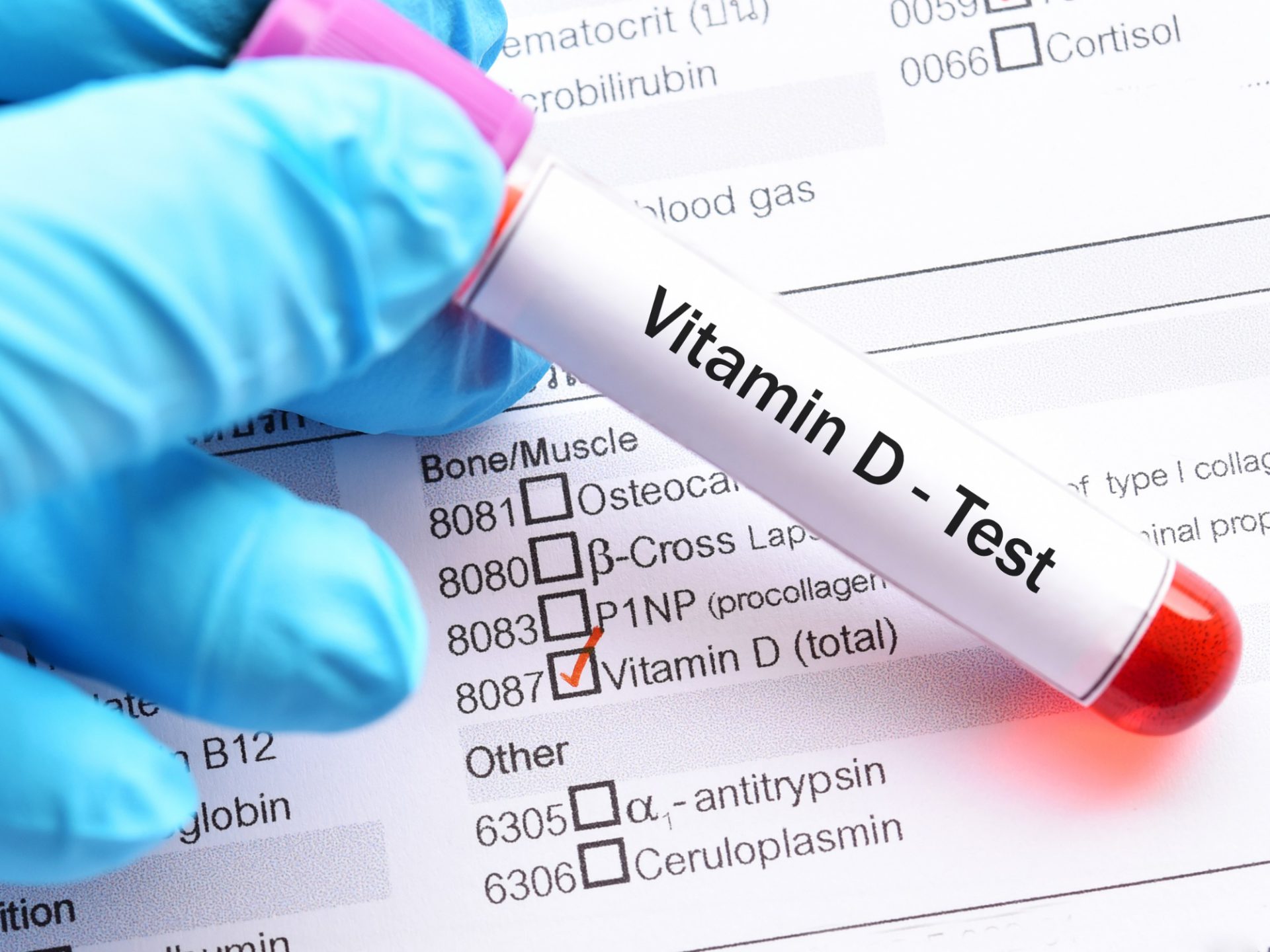 You are currently viewing Unraveling the Hidden Benefits of Vitamin D: A Blood Test You Need Now!