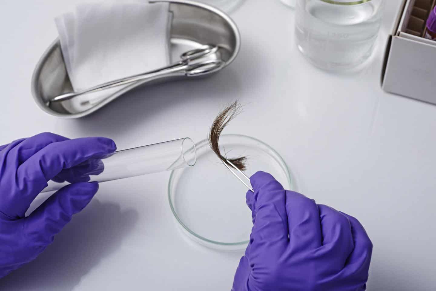 You are currently viewing Hair Follicle Drug Test: Everything You Need to Know