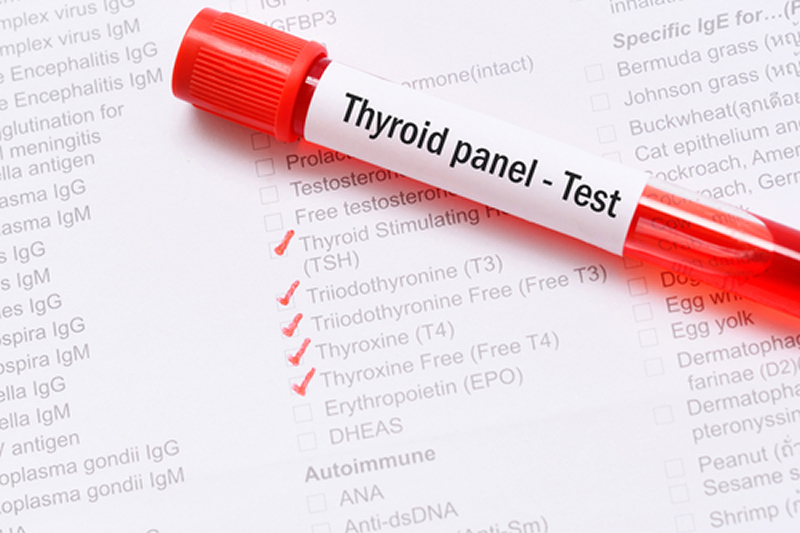 You are currently viewing Thyroid Panel Test: A Comprehensive Guide to Thyroid Health