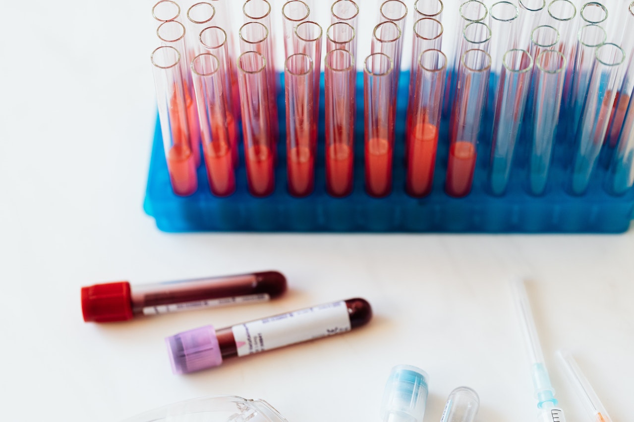You are currently viewing Your Guide to NRBC Blood Test: What It Means and Why It’s Important