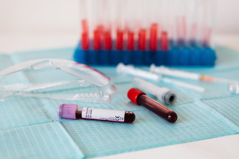 Read more about the article Why Do I Need a Repeat Blood Test?