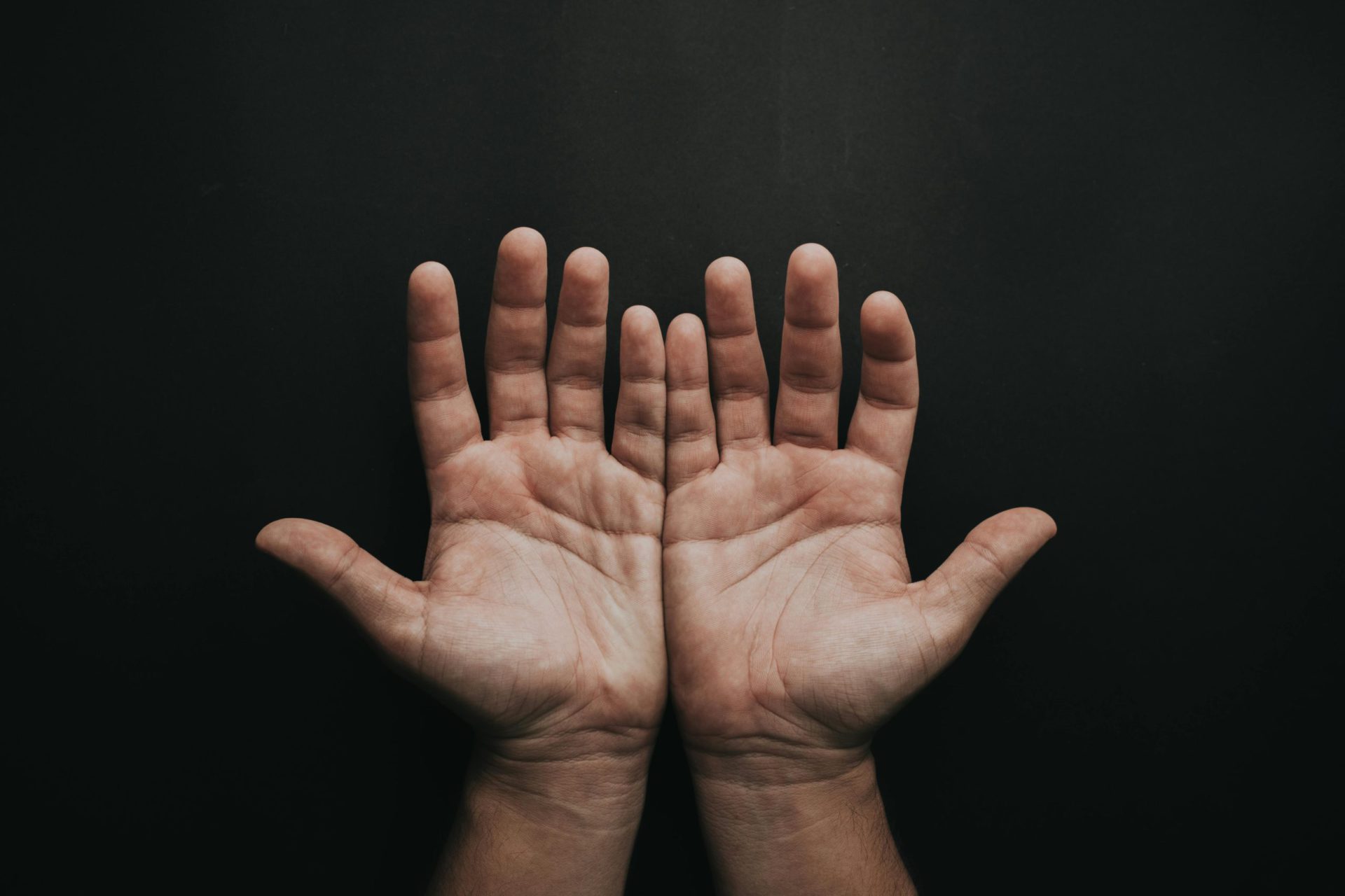 You are currently viewing Why Are My Hands Always Sweaty? The Surprising Truth You Need to Know